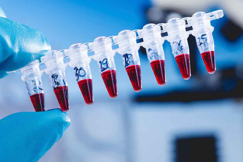 Feature image for Academy for Healthcare Science looking to expand its Assessor pool in Clinical Biochemistry