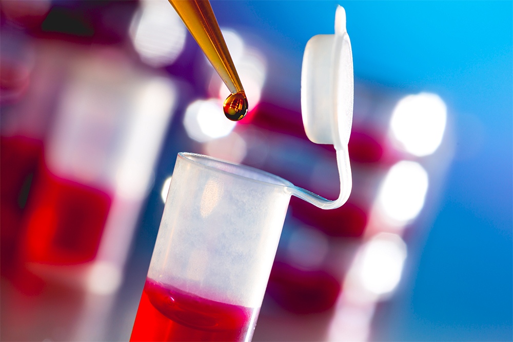Feature image for Immunology and Pathology partnership announced to run training days for trainee clinical scientists