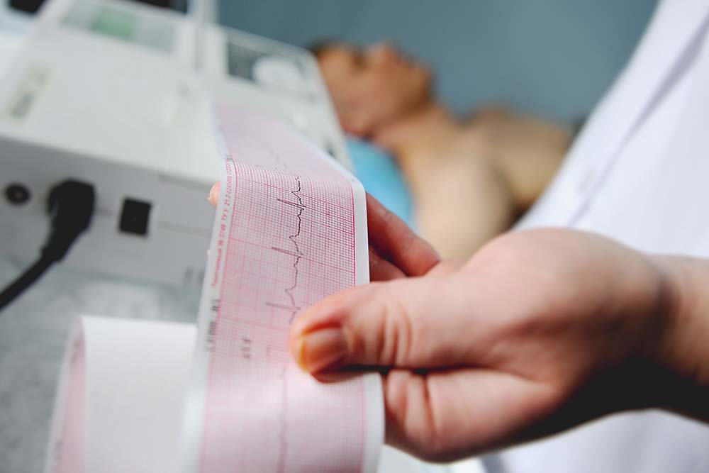 Feature image for King’s College Hospital recruiting into their cardiac department