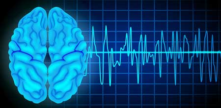 Feature image for Provide your feedback on the new pathway for the Neurophysiology STP in Intraoperative Neuromonitoring